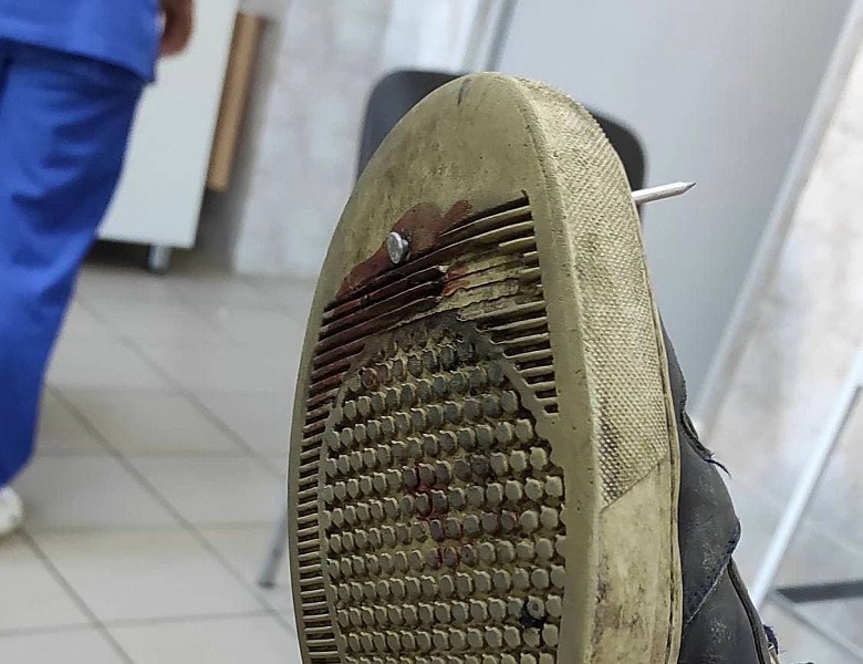 Пациент, 27 лет обратился в приёмное отделение Стационарного отделения N1 ГБУЗ МО «Люберецкой областной больницы»